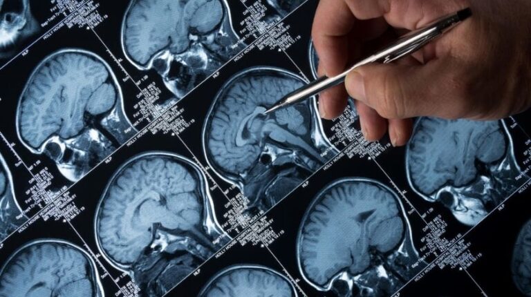 Free CME course on neurological infections of Bartonella