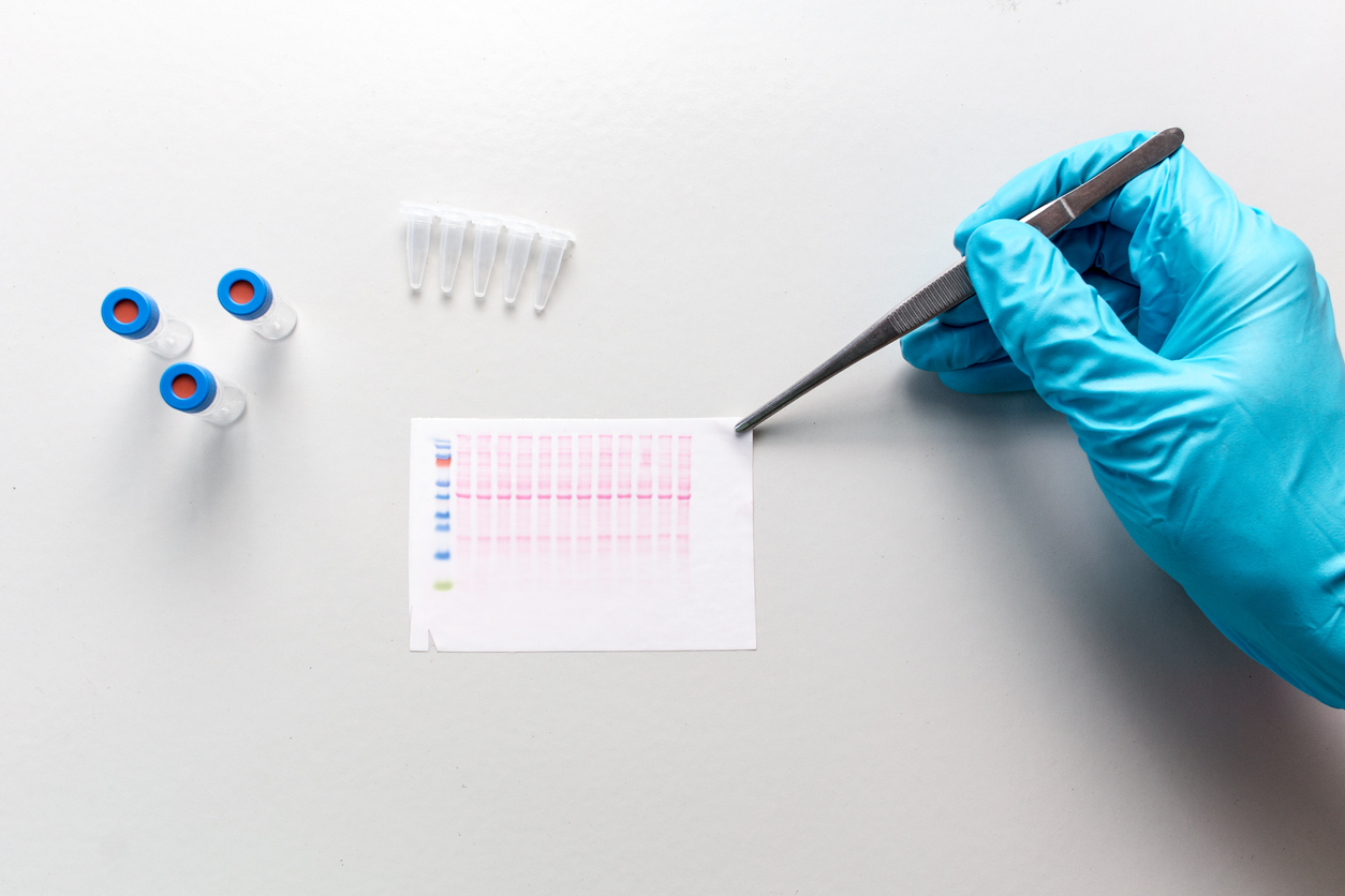 Diagnostic Challenges in Lyme disease