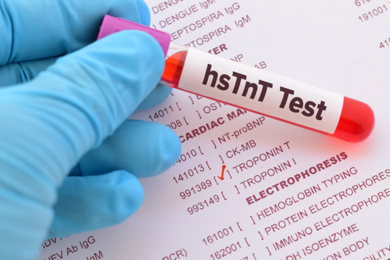 New Massachusetts General Hospital study on important heart issues in Lyme disease patients