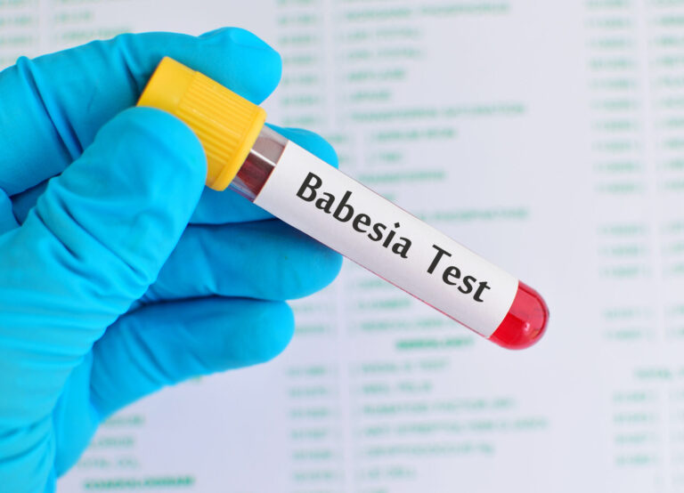 Invisible’s New Course on how to diagnose and treat babesiosis